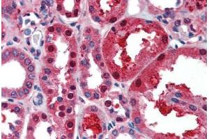 Human Kidney (formalin-fixed, paraffin-embedded) stained with TCF21 antibody ABIN462190 followed by biotinylated goat anti-rabbit IgG secondary antibody ABIN481713, alkaline phosphatase-streptavidin and chromogen.