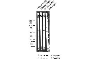 Western blot analysis of Phospho-Synaptotagmin (Thr202) expression in various lysates