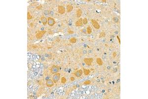 Immunohistochemistry of paraffin embedded rat brain using SLC7A14 (ABIN7075683) at dilution of 1:700 (400x lens) (SLC7A14 anticorps)