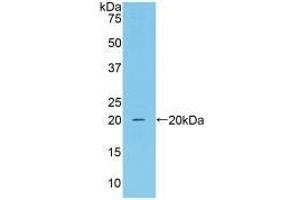 Detection of Recombinant CAT, Mouse using Polyclonal Antibody to Catalase (CAT) (Catalase anticorps  (AA 80-239))