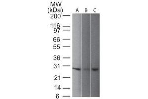 Western blot of UchL1 (PGP9. (UCHL1 anticorps)