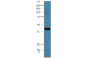 Lane 1:mouse spleen lysate probed with Rabbit Anti-Adenosine deaminase Polyclonal Antibody, Unconjugated  at 1:5000 for 90 min at 37˚C. (ADA anticorps  (AA 65-170))