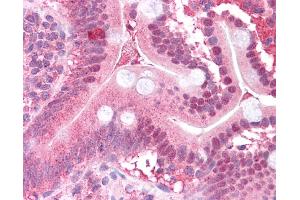 Immunohistochemistry (IHC) image for anti-Mitogen-Activated Protein Kinase Kinase 2 (MAP2K2) (N-Term) antibody (ABIN2783572)