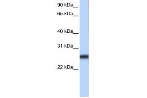 WB Suggested Anti-TMPRSS5 Antibody Titration:  0. (TMPRSS5 anticorps  (Middle Region))