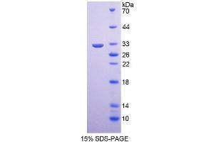 SDS-PAGE (SDS) image for Kallikrein 9 (KLK9) (AA 1-250) protein (His tag) (ABIN6236644) (Kallikrein 9 Protein (KLK9) (AA 1-250) (His tag))