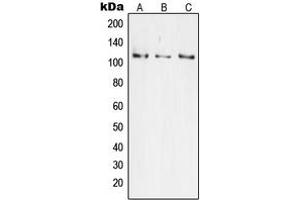 Western blot analysis of JIK expression in HeLa (A), Jurkat (B), HEK293 (C) whole cell lysates. (TAO Kinase 3 anticorps  (Center))