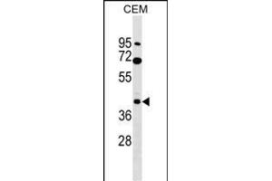 CACNG3 Antibody (N-term) (ABIN1539258 and ABIN2849710) western blot analysis in CEM cell line lysates (35 μg/lane). (CACNG3 anticorps  (N-Term))