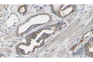 ABIN6277567 at 1/100 staining Human prostate tissue by IHC-P. (EIF4B anticorps  (Internal Region))