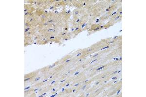 Immunohistochemistry of paraffin-embedded rat heart using RAB24 antibody (ABIN5974578) at dilution of 1/100 (40x lens). (RAB24 anticorps)