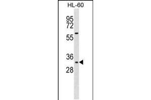 Western blot analysis in HL-60 cell line lysates (35ug/lane). (HOXB13 anticorps  (AA 92-121))
