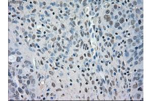 Immunohistochemistry (IHC) image for anti-Budding Uninhibited By Benzimidazoles 1 Homolog beta (Yeast) (BUB1B) antibody (ABIN1497002)