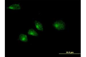 Immunofluorescence of purified MaxPab antibody to GOSR2 on HeLa cell. (GOSR2 anticorps  (AA 1-213))