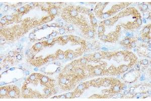 Immunohistochemistry of paraffin-embedded Mouse kidney using RPL7 Polyclonal Antibody at dilution of 1:100 (40x lens).