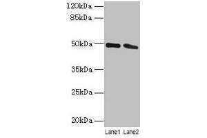 Western blot All lanes: STAMBP antibody at 12 μg/mL Lane 1: Jurkat whole cell lysate Lane 2: Hela whole cell lysate Secondary Goat polyclonal to rabbit IgG at 1/10000 dilution Predicted band size: 49, 40 kDa Observed band size: 49 kDa (STAMBP anticorps  (AA 1-424))