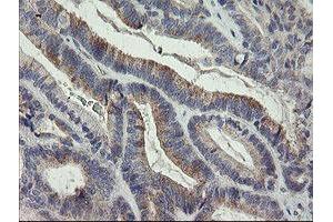 Image no. 1 for anti-Leucine Proline-Enriched Proteoglycan (Leprecan) 1 (LEPRE1) antibody (ABIN1499129)