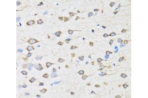 Immunohistochemistry of paraffin-embedded Rat brain using COPB2 Polyclonal Antibody at dilution of 1:100 (40x lens). (COPB2 anticorps)