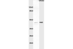 Lane 1: human colon carcinoma lysates probed with Anti phospho-ERK1/2(Thr202 + Tyr204) Polyclonal Antibody, Unconjugated (ABIN682933) at 1:200 in 4 °C. (ERK1/2 anticorps  (pThr202, pTyr204))