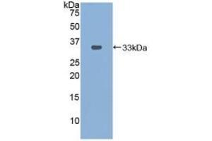 Detection of Recombinant PDXK, Mouse using Polyclonal Antibody to Pyridoxal Kinase (PDXK) (PDXK anticorps  (AA 29-285))