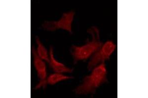 ABIN6276065 staining COLO205 by IF/ICC.