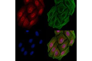 ABIN6258197 and ABIN6273942 staining Hela cells by IF/ICC.