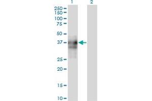 Western Blot analysis of SPARC expression in transfected 293T cell line by SPARC monoclonal antibody (M04A), clone 1A2. (SPARC anticorps  (AA 1-303))