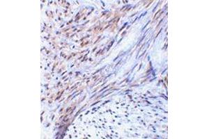 Immunohistochemistry of TRIM5 alpha in human uterus tissue with this product at 2 μg/ml. (TRIM5 anticorps  (Isoform alpha, Middle Region))
