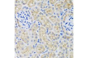 Immunohistochemistry of paraffin-embedded mouse kidney using SULT1A1 antibody (ABIN5970776) at dilution of 1/100 (40x lens). (SULT1A1 anticorps)