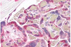 anti-Syntaxin Binding Protein 2 (STXBP2) (AA 58-70) antibody