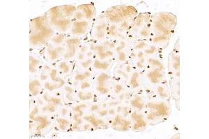 Immunohistochemistry of paraffin embedded mouse Skeletal muscle using USP24 (ABIN7076111) at dilution of 1:1000 (400x lens)