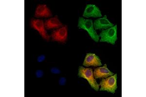 ABIN6265615 and ABIN6273177 staining Hela cells by IF/ICC.