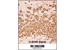 Mouse Dapk3 Antibody immunohistochemistry analysis in formalin fixed and paraffin embedded mouse brain tissue followed by peroxidase conjugation of the secondary antibody and DAB staining. (DAPK3 anticorps  (AA 255-282))