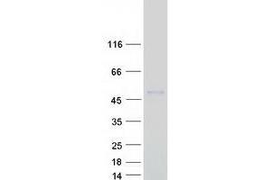 Validation with Western Blot