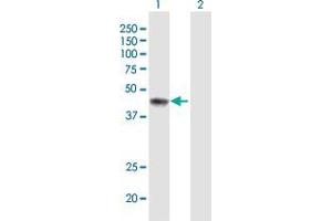 Western Blot analysis of ERCC8 expression in transfected 293T cell line by ERCC8 MaxPab polyclonal antibody. (ERCC8 anticorps  (AA 1-396))