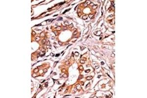 Image no. 2 for anti-Retinoblastoma 1 (RB1) (pSer249) antibody (ABIN358210) (Retinoblastoma 1 anticorps  (pSer249))