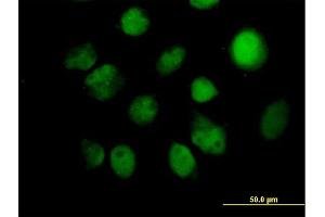 Immunofluorescence of purified MaxPab antibody to ITPK1 on HeLa cell. (ITPK1 anticorps  (AA 1-314))