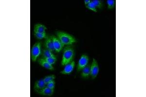Immunofluorescence staining of HepG2 cells with ABIN7157699 at 1:200, counter-stained with DAPI. (KRIT1 anticorps  (AA 471-585))