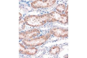 Immunohistochemistry of paraffin-embedded Rat kidney using CHDH Rabbit pAb (ABIN7266341) at dilution of 1:100 (40x lens).
