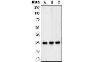 Western blot analysis of PEX11B expression in HT29 (A), THP1 (B), Jurkat (C) whole cell lysates. (PEX11B anticorps  (Center))