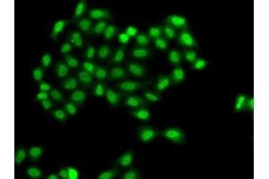 Immunofluorescence analysis of  cells using PHF11 antibody (ABIN6128437, ABIN6145533, ABIN6145535 and ABIN6217420). (PHF11 anticorps  (AA 1-292))