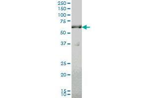SLC19A2 monoclonal antibody (M10), clone 5B10 Western Blot analysis of SLC19A2 expression in A-431 .