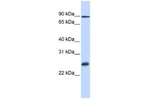 WB Suggested Anti-RBPMS Antibody Titration:  0. (RBPMS anticorps  (Middle Region))