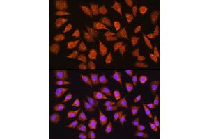Immunofluorescence analysis of L929 cells using IMPDH1 Rabbit pAb (ABIN6133190, ABIN6142433, ABIN6142434 and ABIN6225023) at dilution of 1:100 (40x lens).