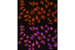 Immunofluorescence analysis of L929 cells using IMPDH1 Rabbit pAb (ABIN6133190, ABIN6142433, ABIN6142434 and ABIN6225023) at dilution of 1:100 (40x lens).