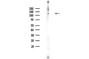 Western blot analysis of lysates from COLO205 cells, using Sin3B Antibody at 1/1000 dilution.