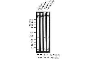 Western blot analysis of Phospho-SNAI1 (Ser246) expression in various lysates