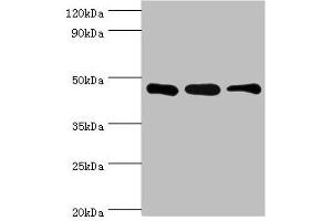 Western blot All lanes: SUGCT antibody at 16 μg/mL Lane 1: Mouse skeletal muscle tissue Lane 2: Mouse liver tissue Lane 3: Mouse kidney tissue Secondary Goat polyclonal to rabbit IgG at 1/10000 dilution Predicted band size: 49, 48, 52, 44 kDa Observed band size: 42 kDa (SUGCT anticorps  (AA 1-250))