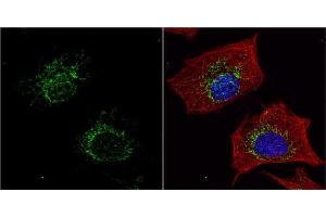 anti-Medium-Chain Specific Acyl-CoA Dehydrogenase, Mitochondrial (MCAD) (Center) antibody