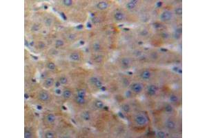 IHC-P analysis of Liver tissue, with DAB staining. (IGFBP4 anticorps  (AA 22-258))
