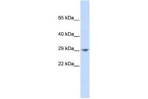 KCNN2 antibody used at 1 ug/ml to detect target protein. (KCNN2 anticorps  (Middle Region))