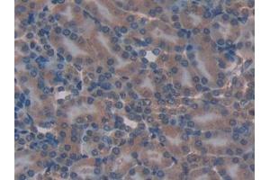 Detection of TFAM in Mouse Kidney Tissue using Polyclonal Antibody to Transcription Factor A, Mitochondrial (TFAM)